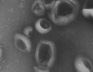 Extracellular vesicles (microscopic image)