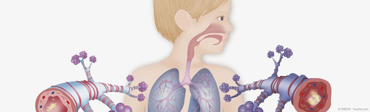 Research at CPC-M - Children’s interstitial lung disease – chILD