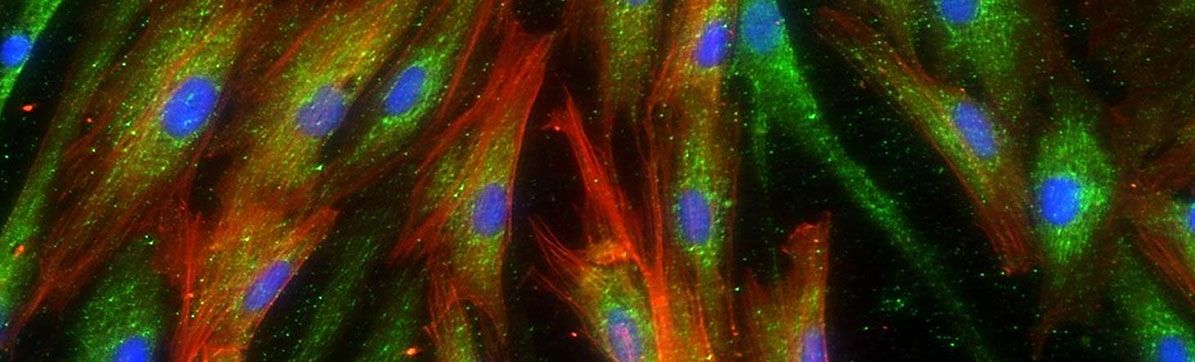 Research at CPC-M - Pulmonary fibrosis – slowing disease progression by stopping collagen formation